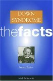 Down Syndrome: the facts
