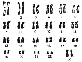 Normal Karyotype